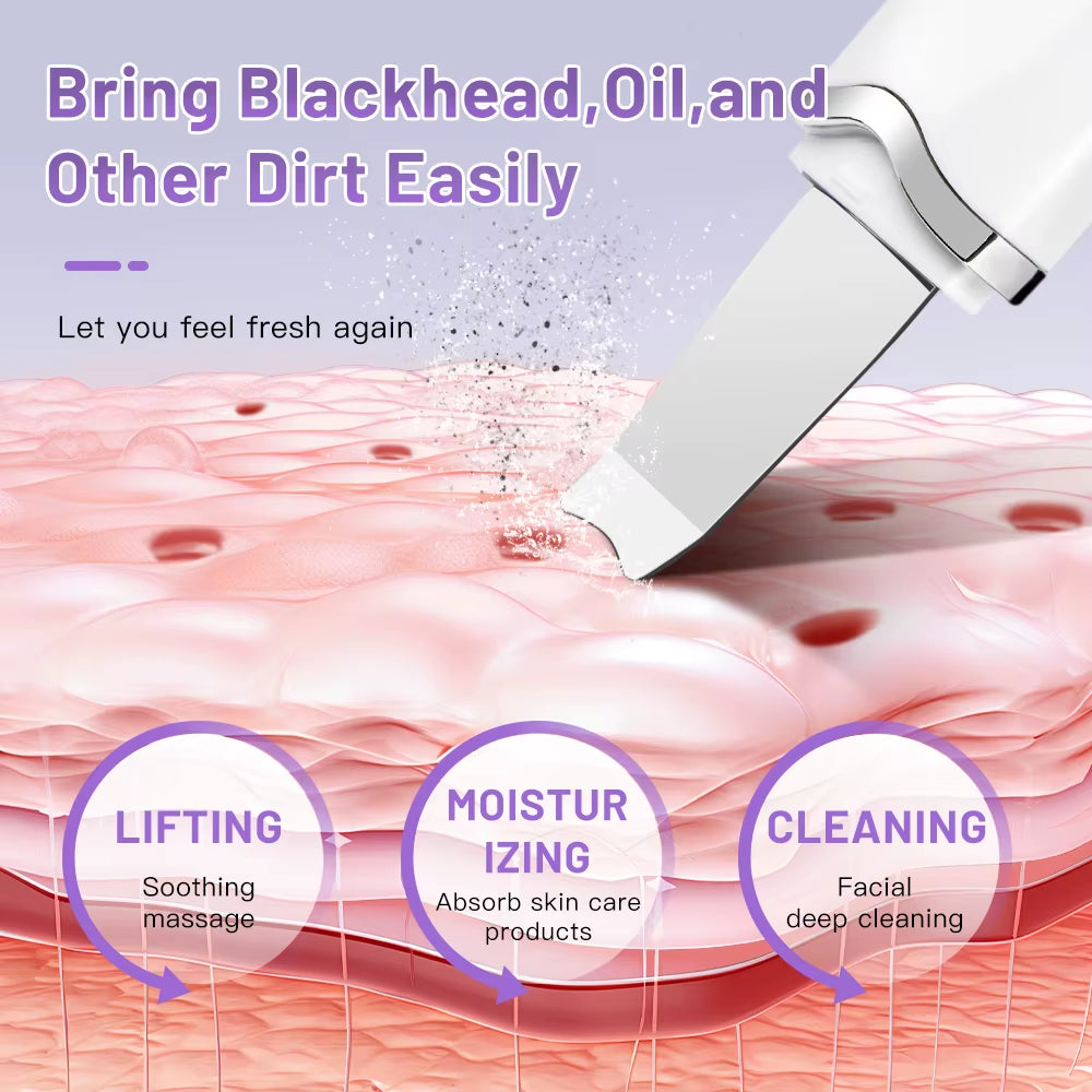 Ultrasonic Facial Skin Scrubber — Deep Pore & Blackhead Cleansing Spatula