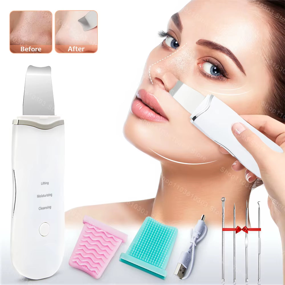 Ultrasonic Facial Skin Scrubber — Deep Pore & Blackhead Cleansing Spatula