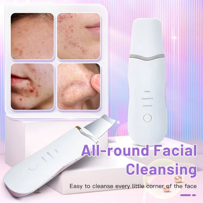 Ultrasonic Facial Skin Scrubber — Deep Pore & Blackhead Cleansing Spatula